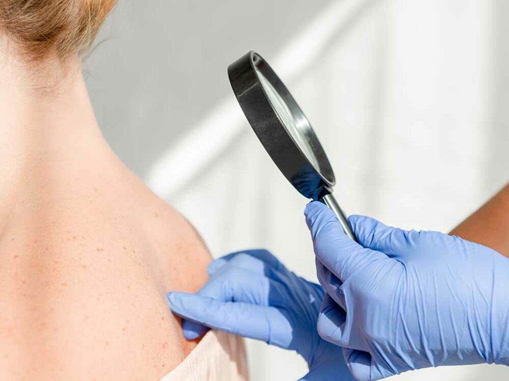 Untersuchung der Haut im Rahmen der allgemeinen Dermatologie