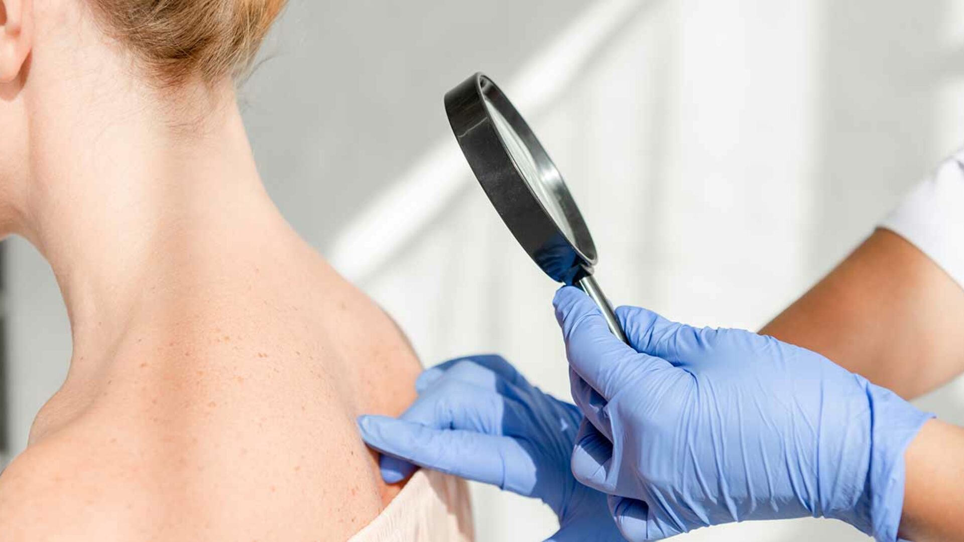 Untersuchung der Haut im Rahmen der allgemeinen Dermatologie