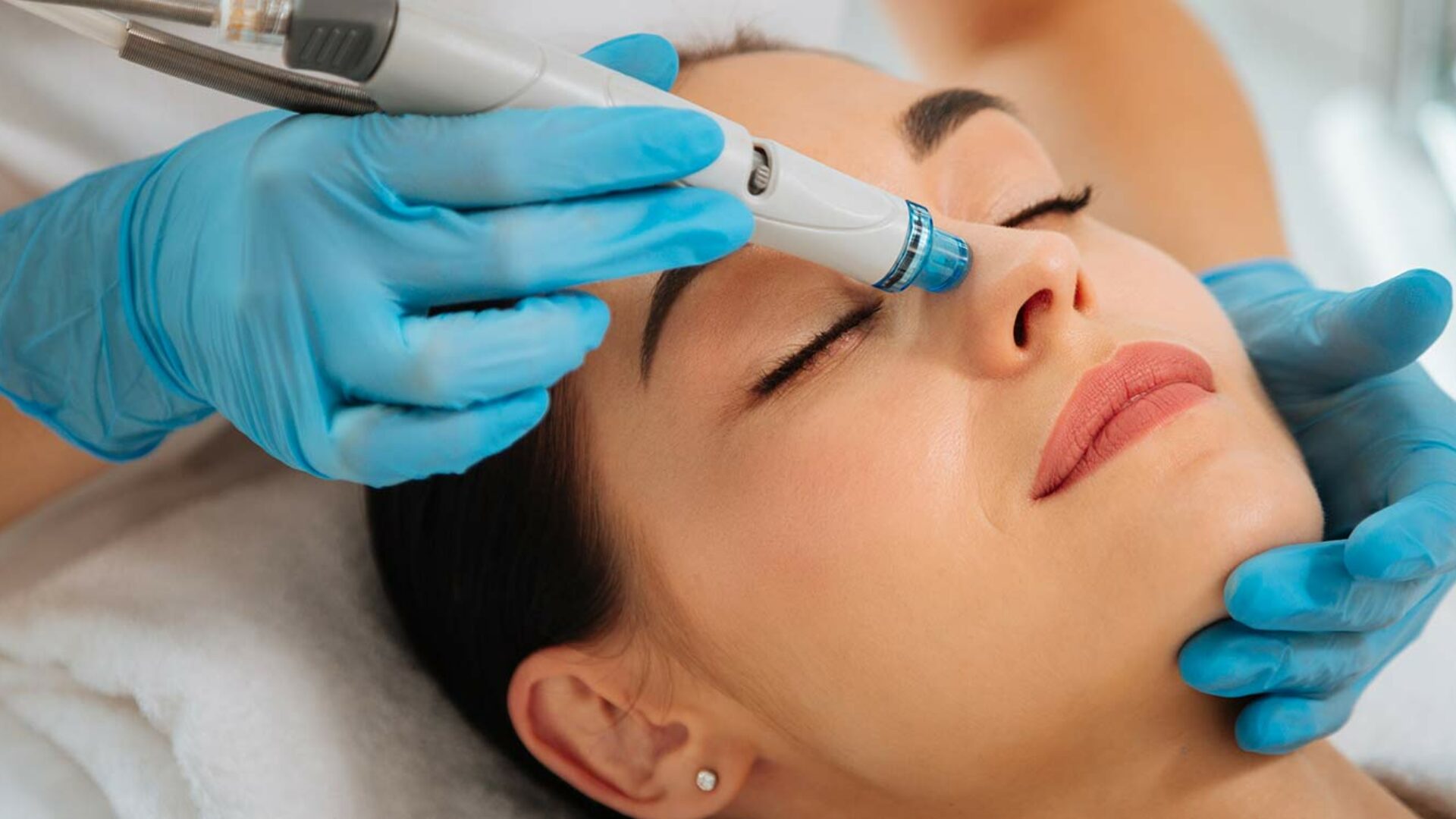 Hydrafacial