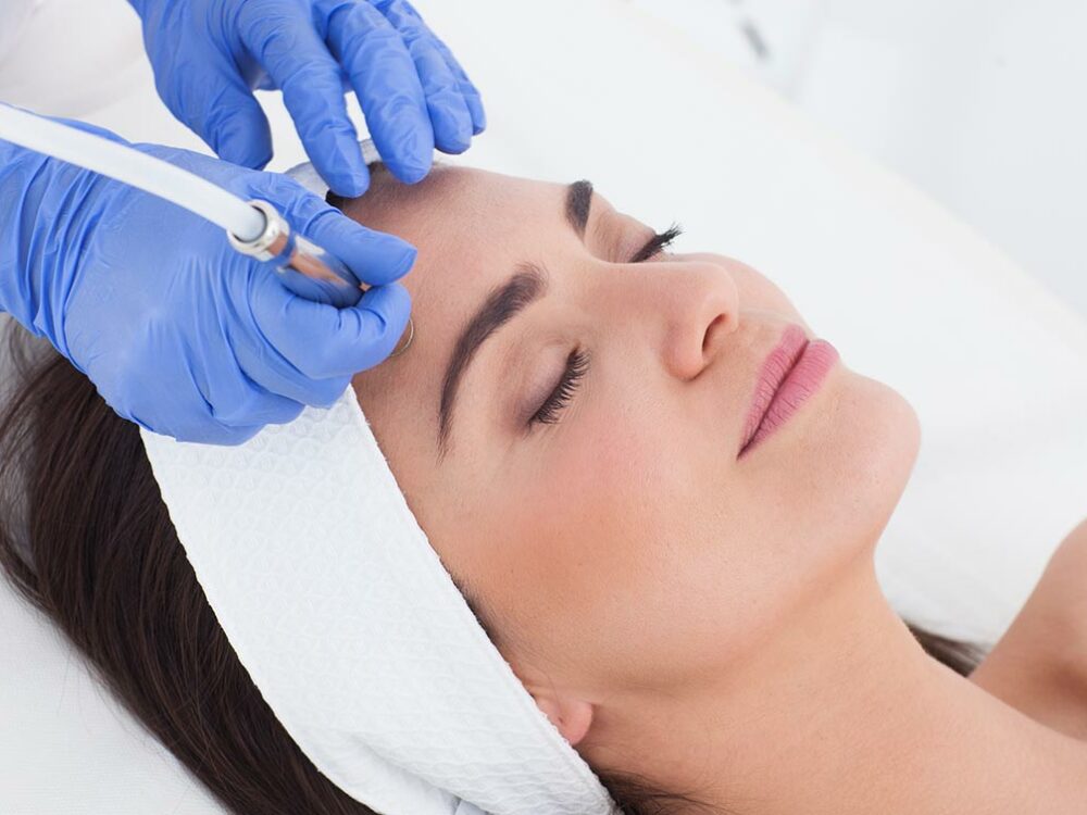Mikrodermabrasion beim Hautarzt