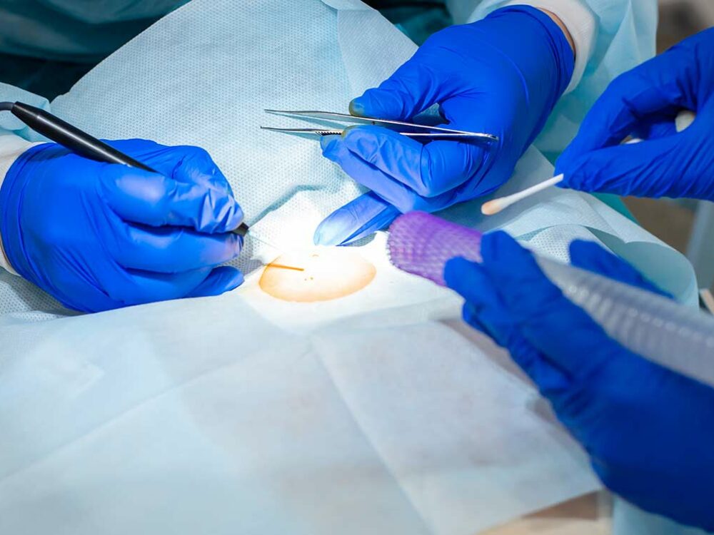 Operative Dermatologie in Bonn