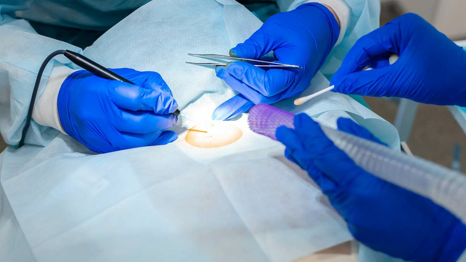 Operative Dermatologie in Bonn