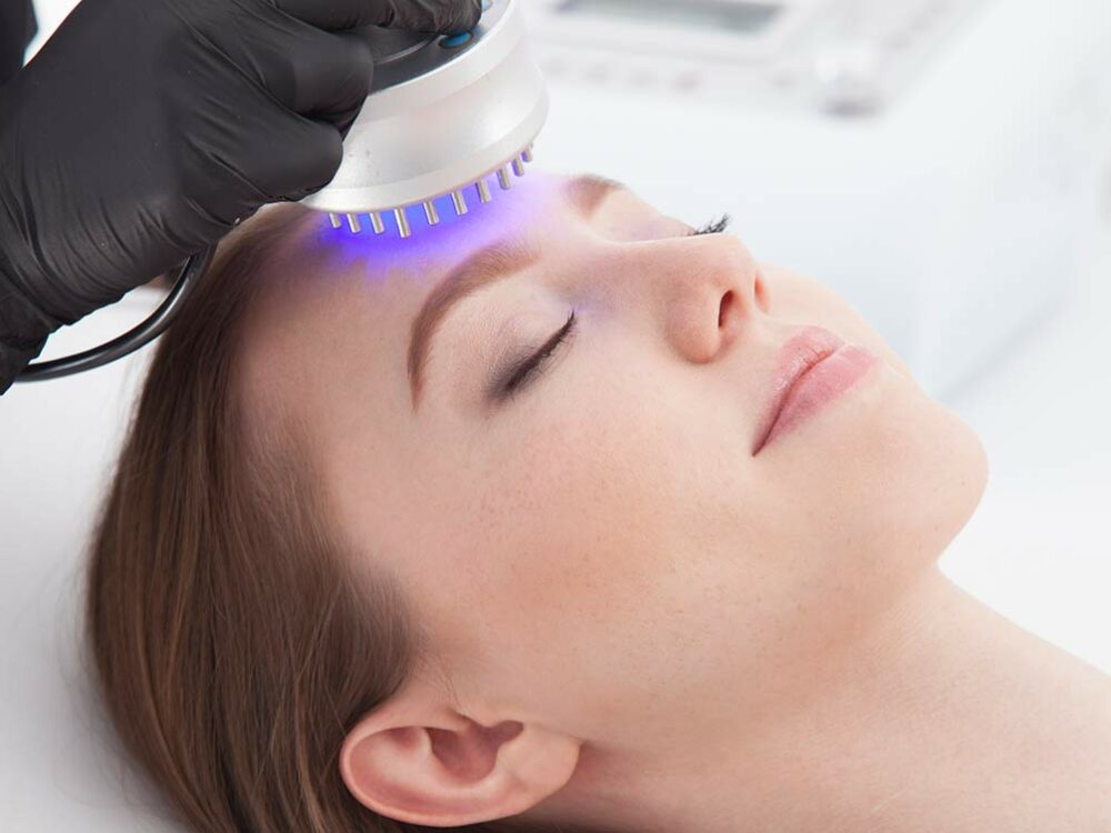 Photodynamische Therapie bei Aktinischer Keratose