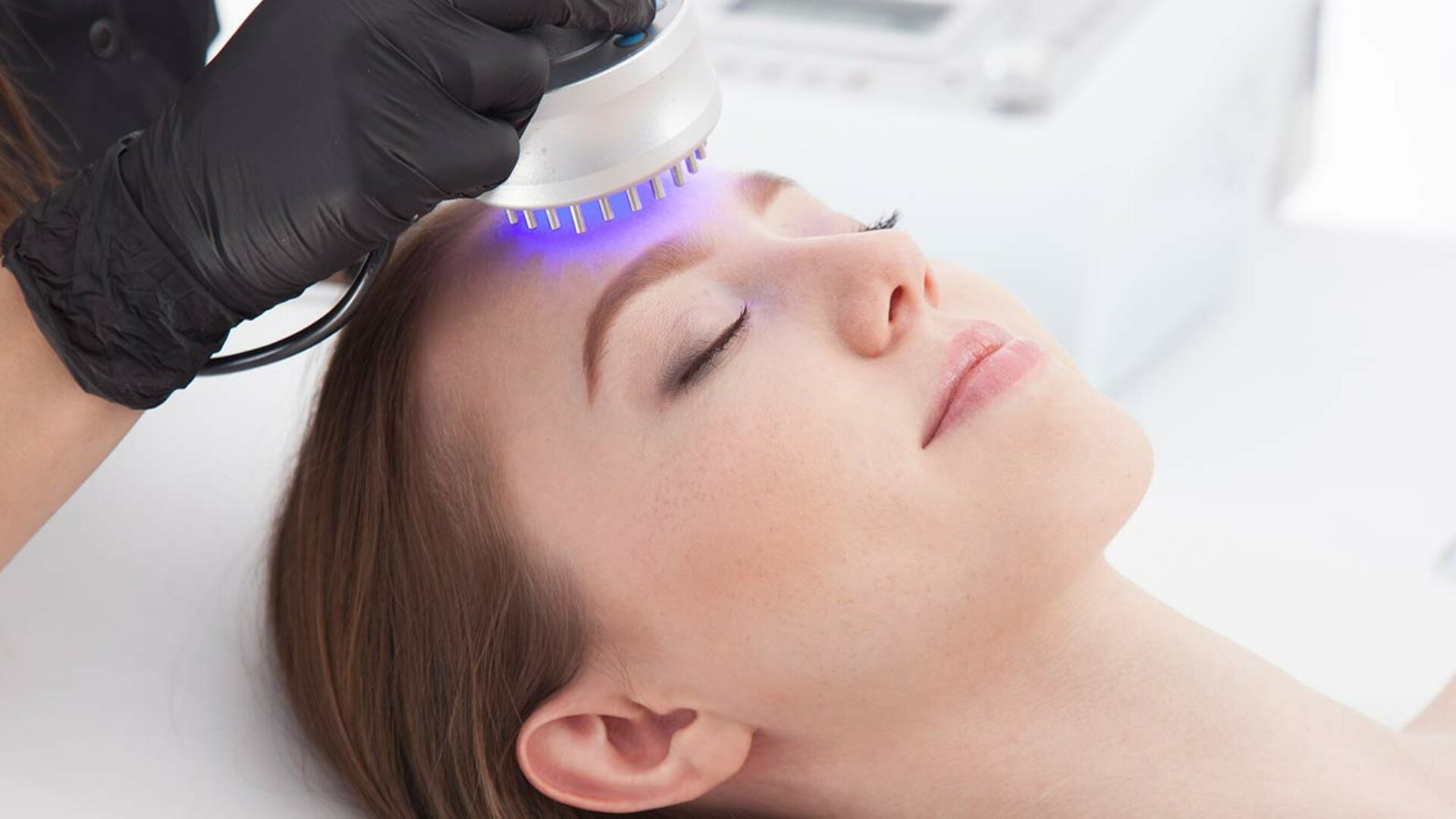 Photodynamische Therapie bei Aktinischer Keratose