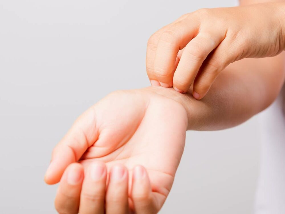 Schuppenflechte behandeln lassen vom Hautarzt in Bonn