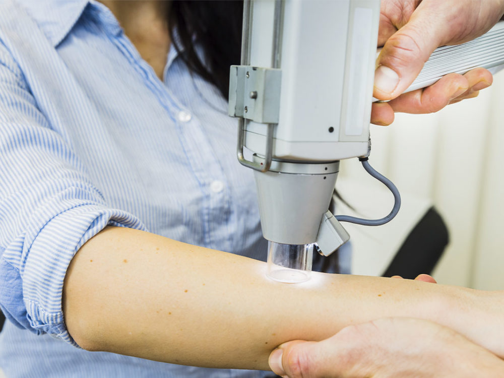 Untersuchung der Haut auf auffällige Muttermale