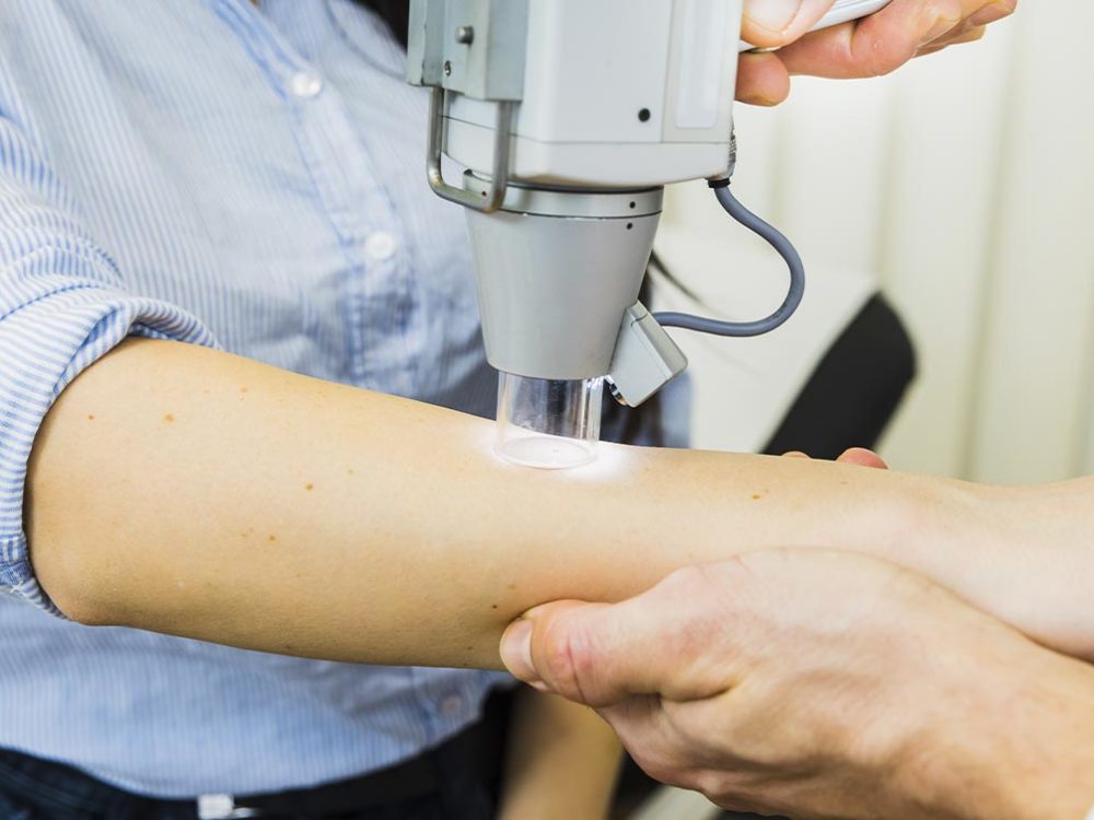 Hautkrebs-Screening der Haut