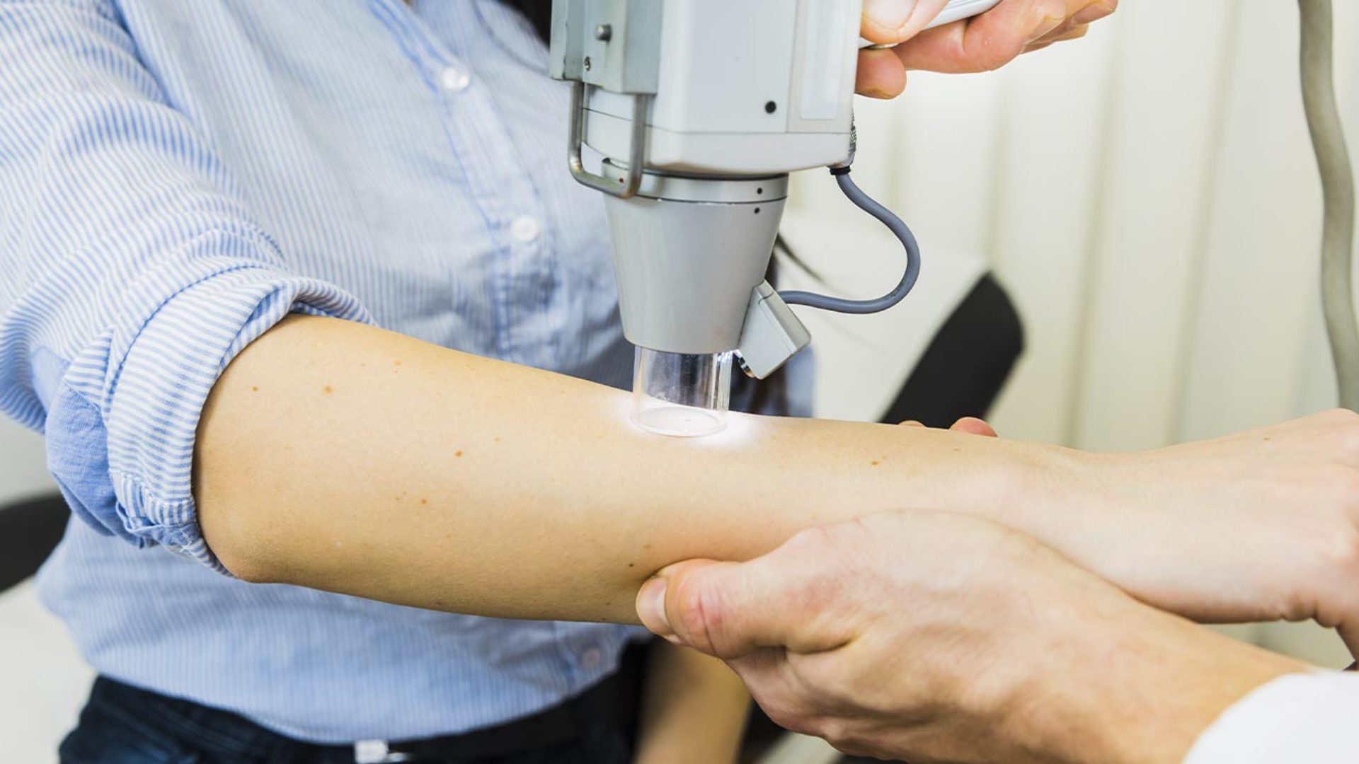 Hautkrebs-Screening der Haut