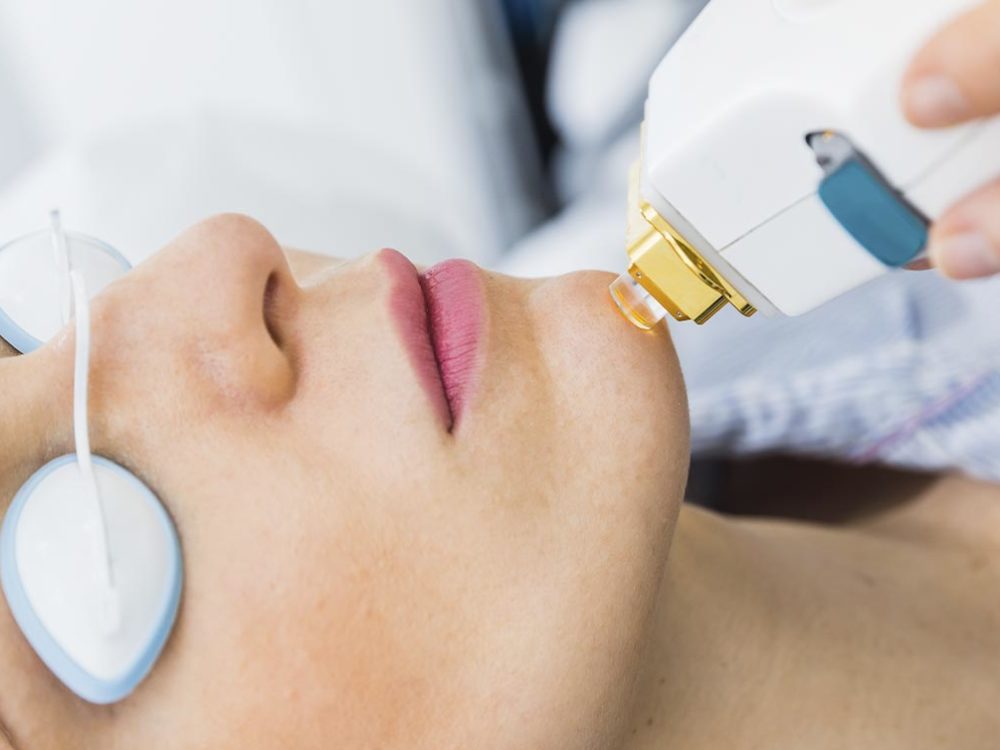 Verjüngung der Haut mittels moderner Technologie