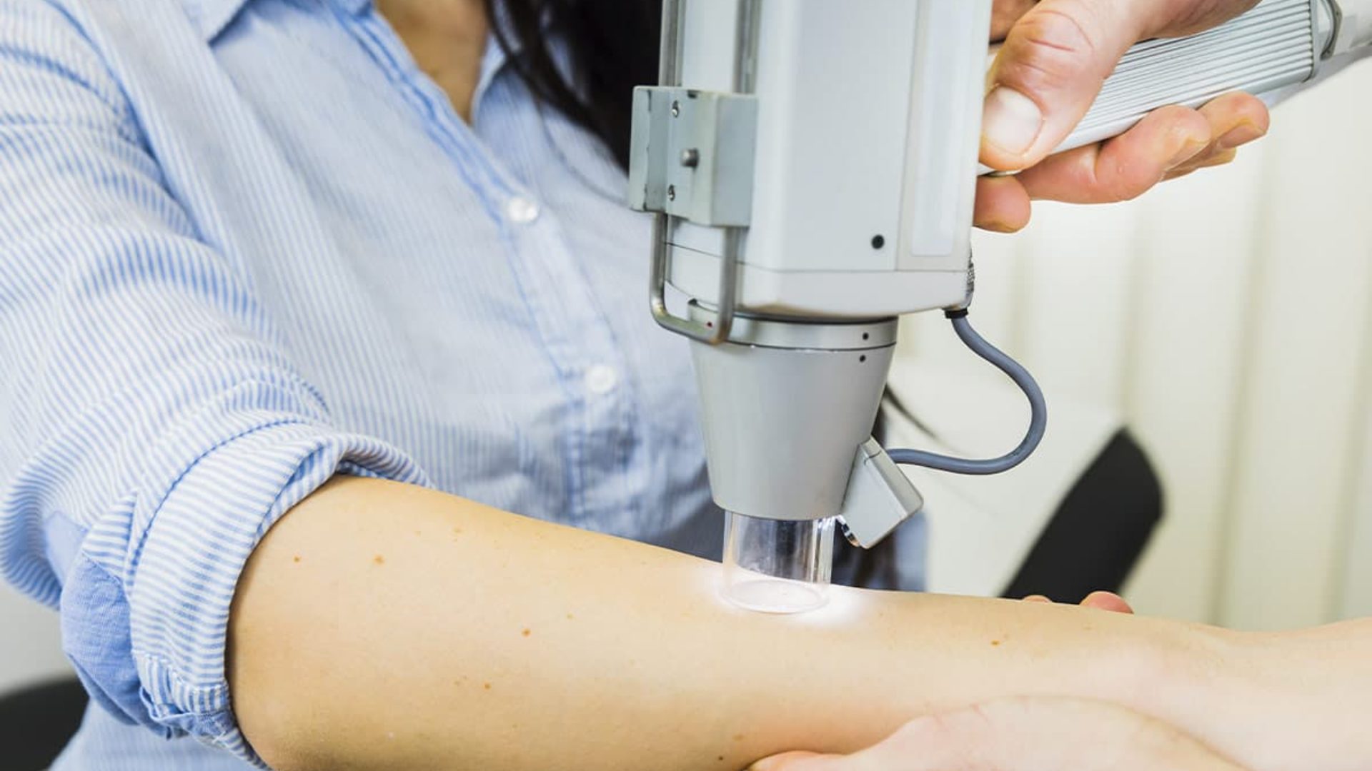 Untersuchung der Haut auf auffällige Muttermale